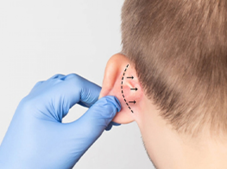 Ear Aesthetics